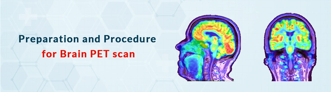 Preparation and Procedure for Brain PET Scan